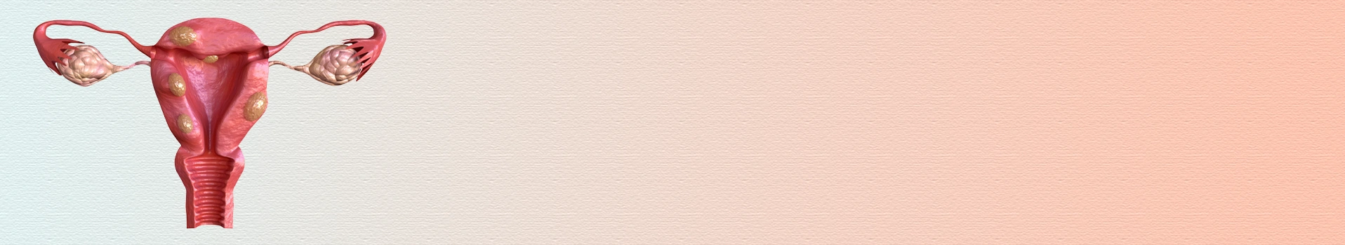 PCOS symptoms and fertility effects